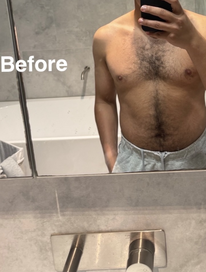 Before weight loss transformation front view